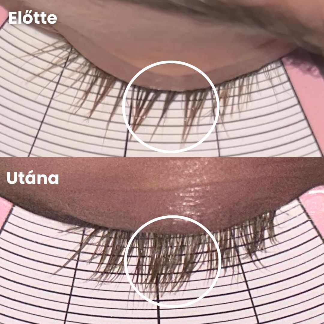 Szempillanövesztő szérum